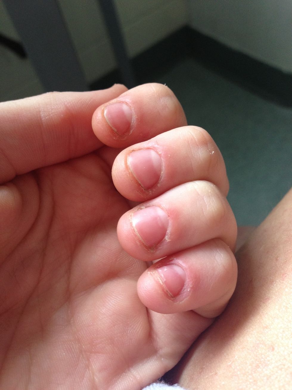 How To Fix And Grow Out Bitten Nails B C Guides