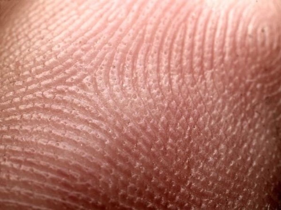 This is a picture of the human skin