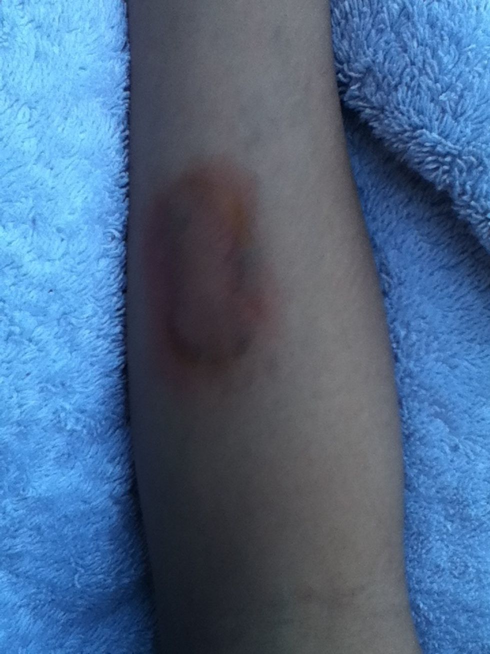 This is my finished bruise, you can add more colours, use different shades, different Size and shaped, have fun and I hope this works for you :)