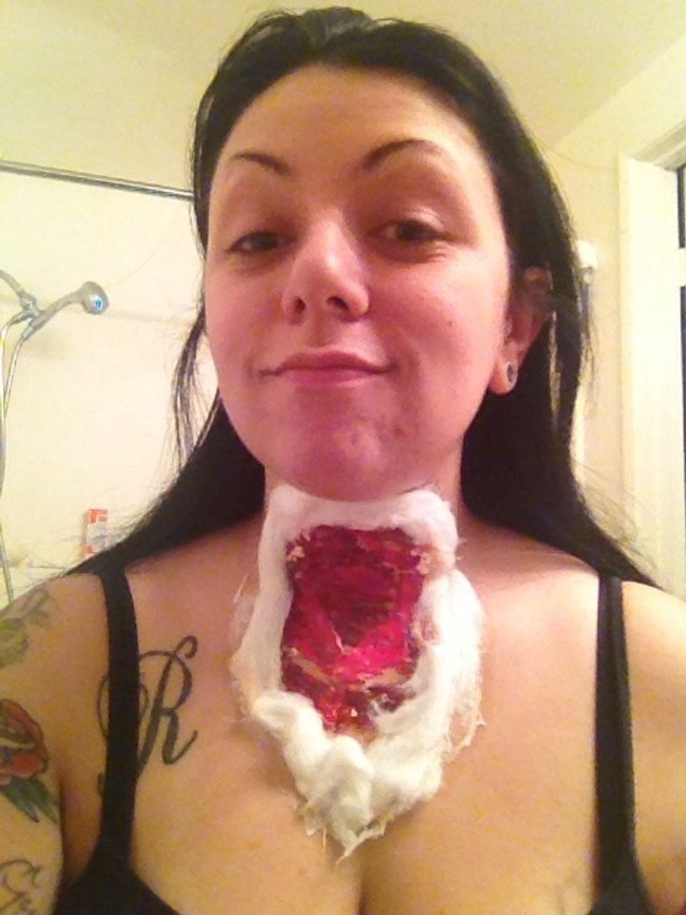 This is the result. Looks like Santa is on my throat. Hahaha.