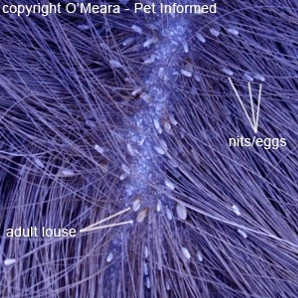 This is what lice eggs look like.