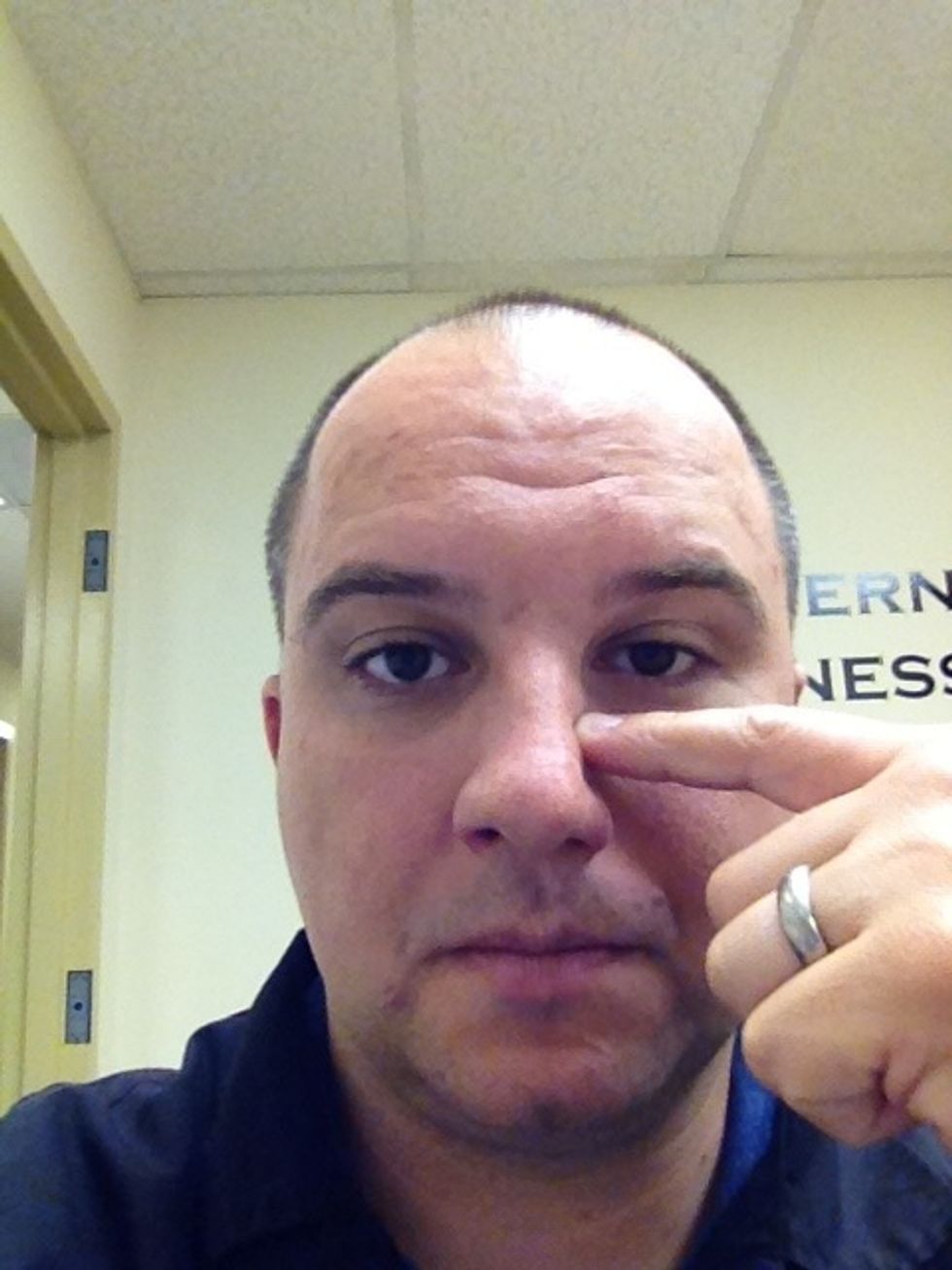 This point is located at the boney part of the nose. Follow the side of the nose up until you feel the bone. Pinching and pulling up slightly can stimulate the point on both sides of the nose