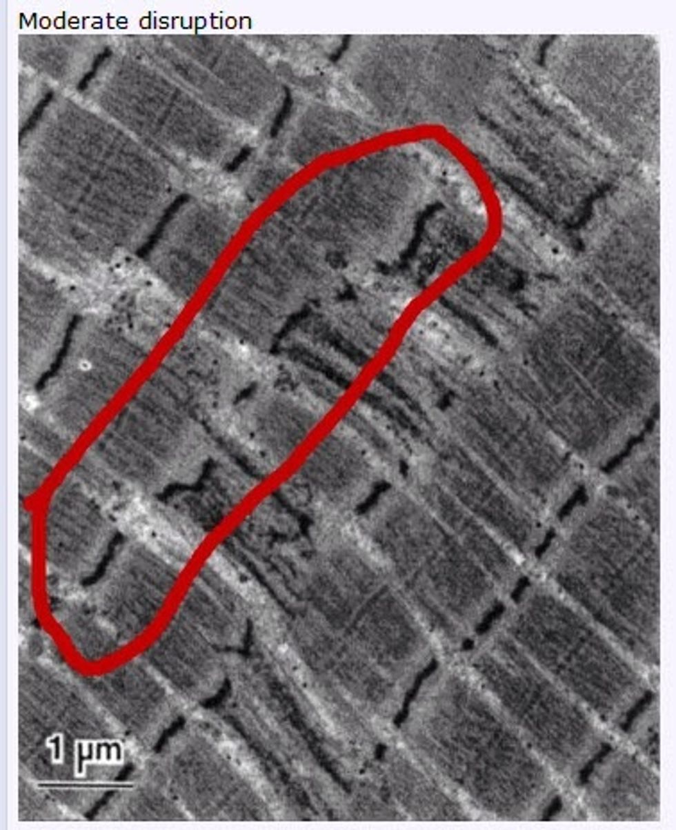TIP: If your legs are sore, wait a day and let your muscles repair. On a cellular level, you'll build more speed and strength by resting a day than destroying more fibres two days in a row.