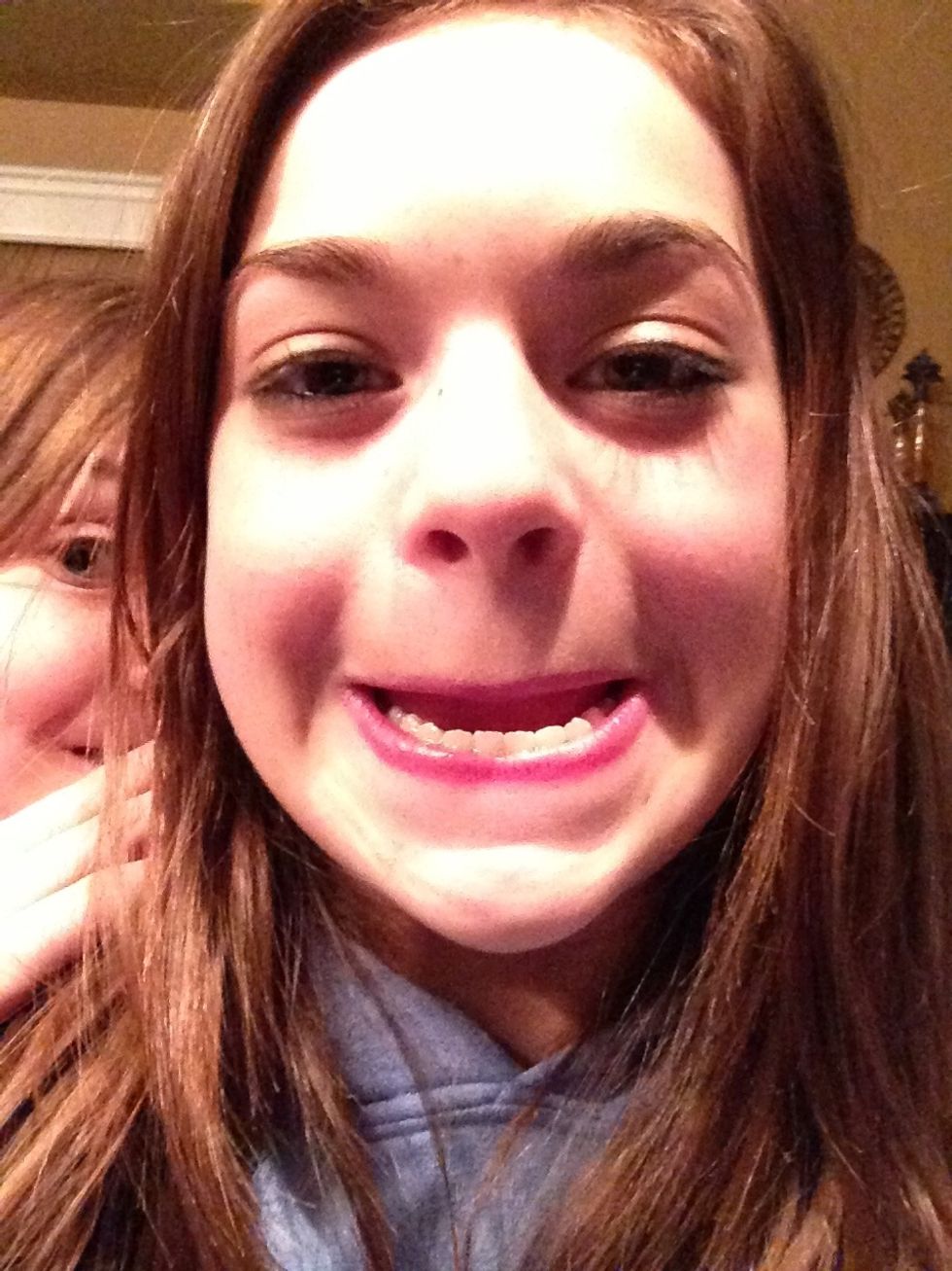 Underbite smile. Not preferred.