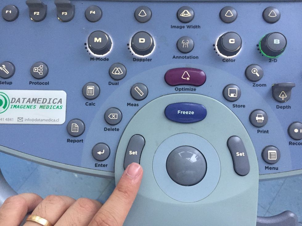 Usar "SET" para seleccionar