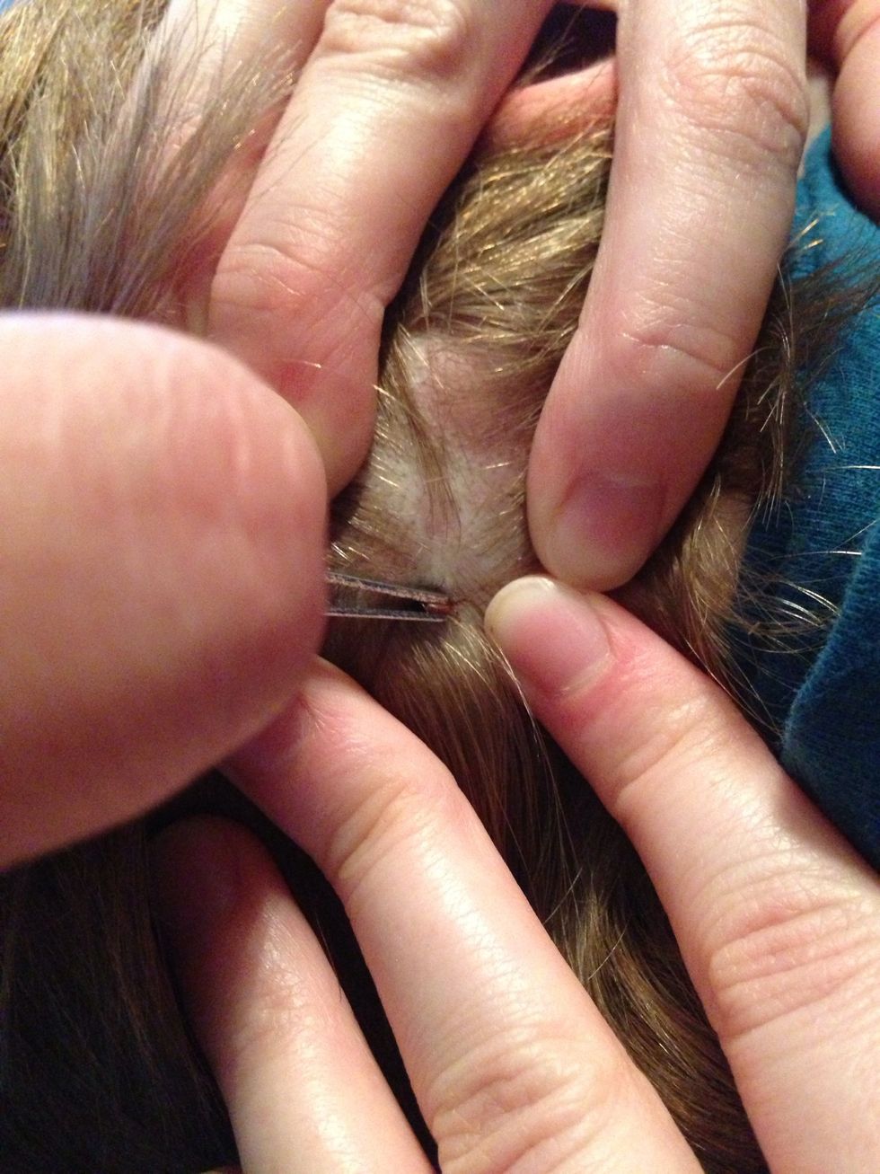 Use your tweezers to grab hold of the tick as close to the skin as possible. Pull (slowly but firmly) straight out without twisting. You want to pull the whole tick out slowly without losing the head.