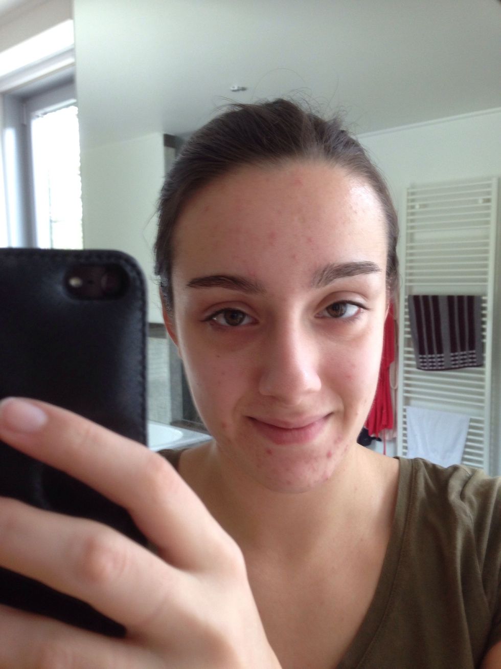 Wash your face and put on some moisturizer