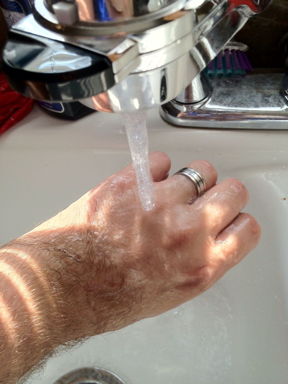 Wash your hands before and after handling the raw ground beef. Unless you like getting sick, some people like the attention. Google munchausen syndrome.