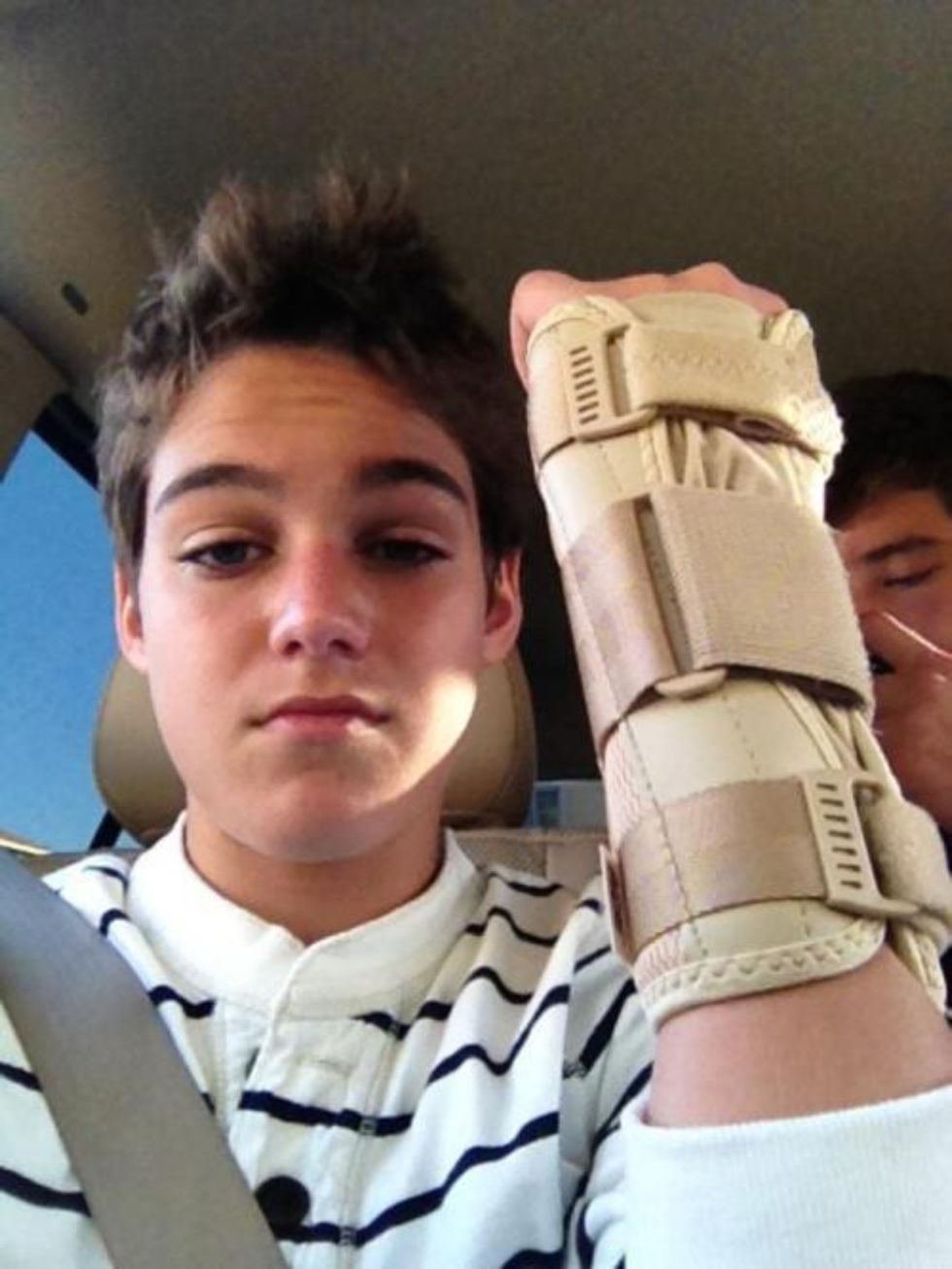 When I broke my arm skating..