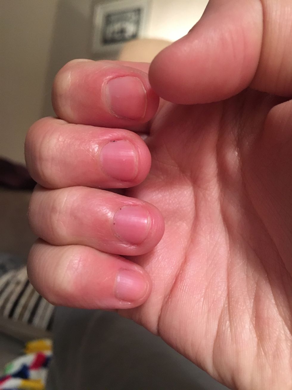 Yay! Just 4 days later (no biting and nail growth serum application daily) and my nails don't look as bad! Fair enough, there's no white edges, but they look presentable now. Keep growing! \ud83d\ude4f\ud83c\udffb