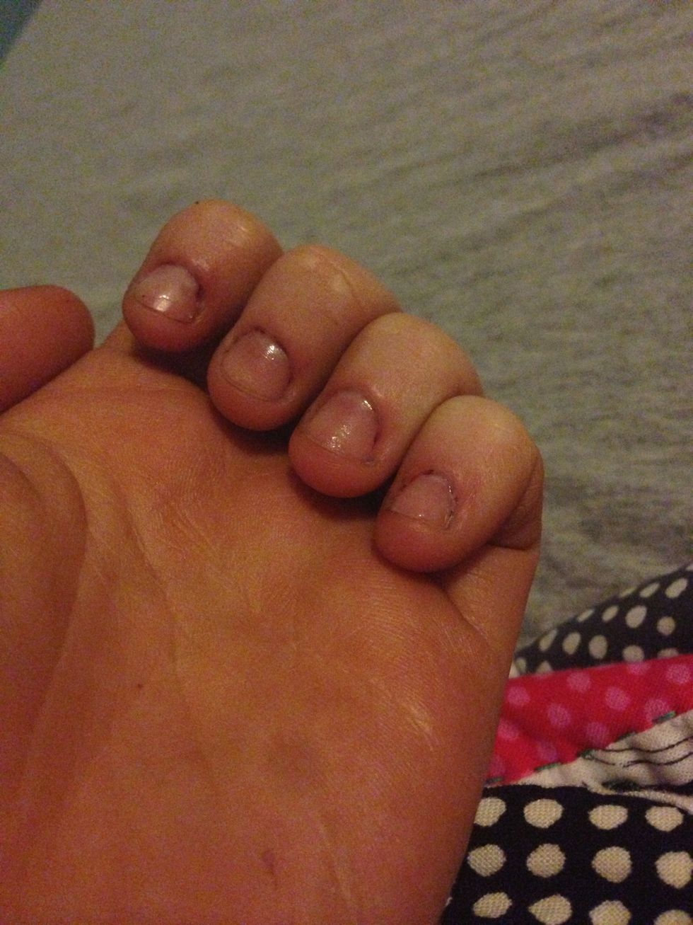 Yes!! Over a week of not biting!! Don't want to bite anymore after this much progress! Keep up they good work, everyone!
